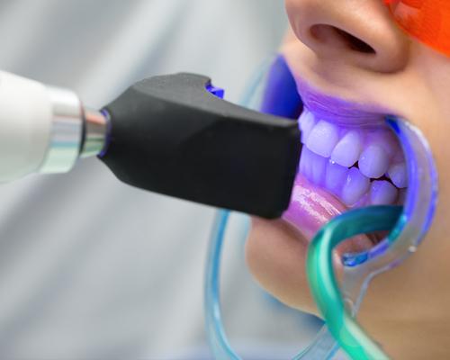 Diş Beyazlatma Tedavisi - Batı Ortodonti